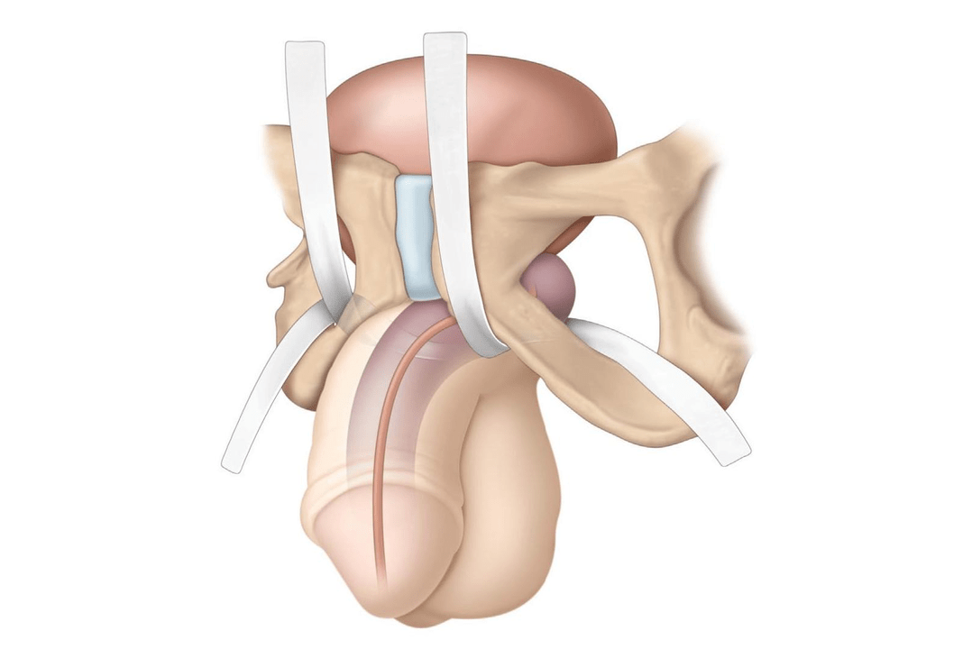 locations that are investigated for the presence of fillers