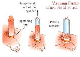 how the pump works