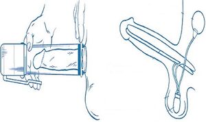 penis enlargement pump principle
