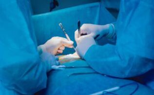 Ligamentotomy - surgery to increase the length of the penis