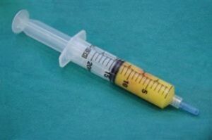 a syringe with adipose tissue to enlarge the penis