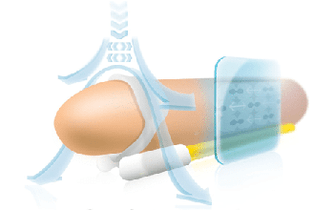 The principle of operation of the extender for stretching the phallus along the length